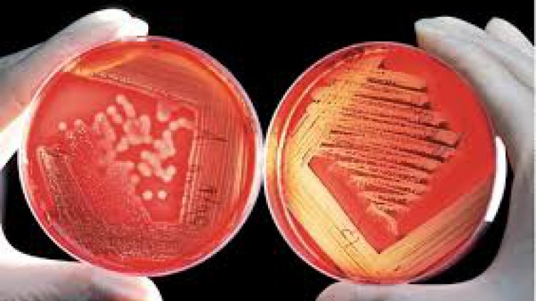 Хората с нулева кръвна група изкарват по-леко коронавируса