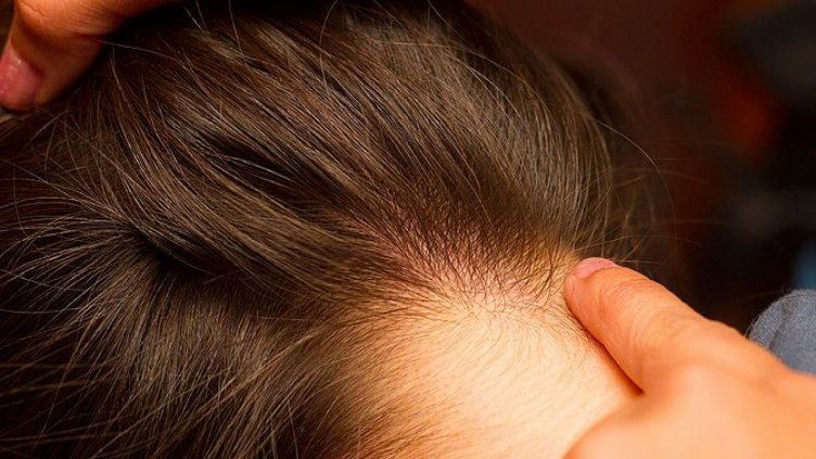 Ще проверяват за въшки учениците всяка седмица