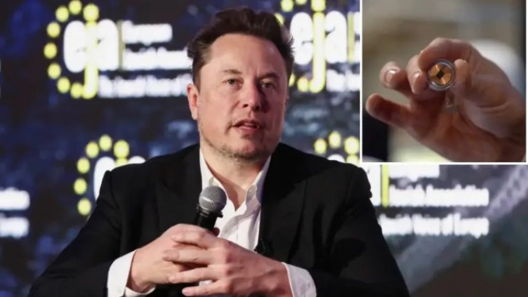 Мъск имплантира мозъчен чип на човек