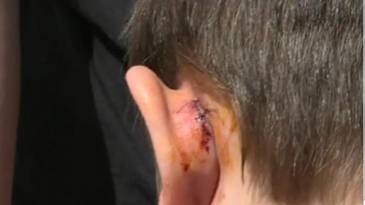 Питбул нахапа 5-годишно, собственикът си тръгнал