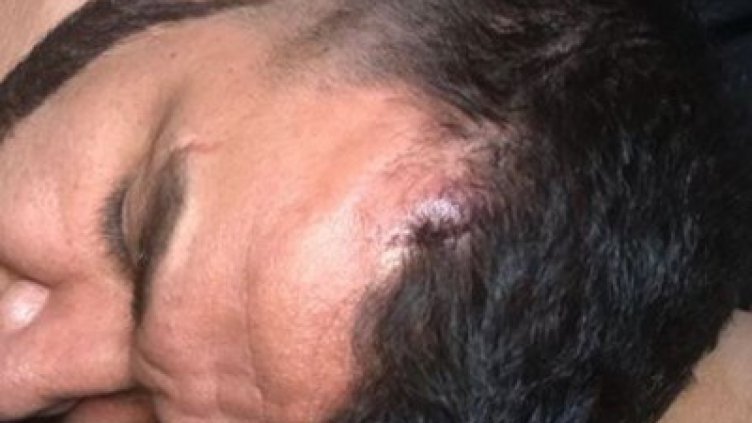 Азис пял пред три хиляди души с разбита глава  