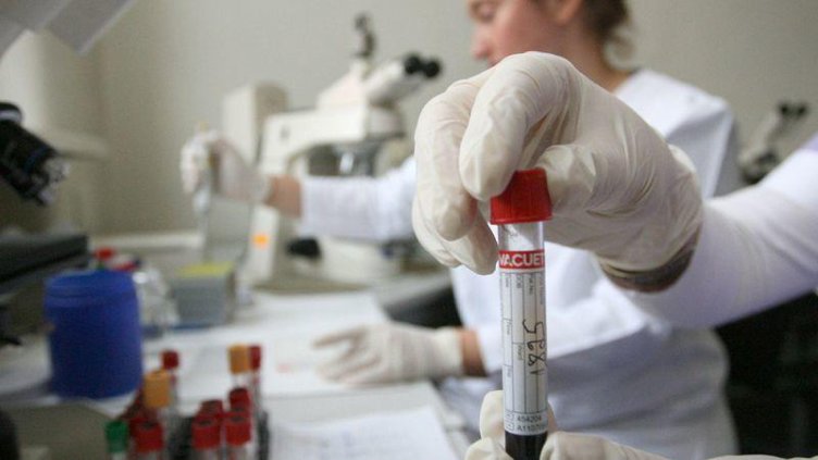 22 деца от Сливен в болница след хранително отравяне