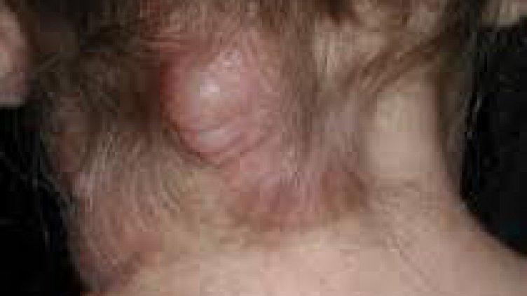 Непознат досега протеин може да пребори рака