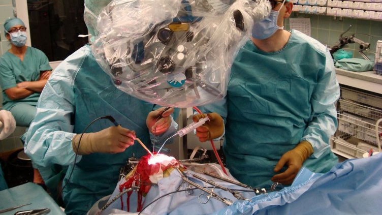 Консумативите при лечение на инсулт в УМБАЛ „Света Марина“ се поемат от МЗ