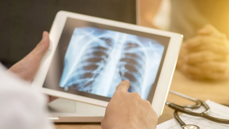 Жълтата гостенка навести 45 варненски семейства