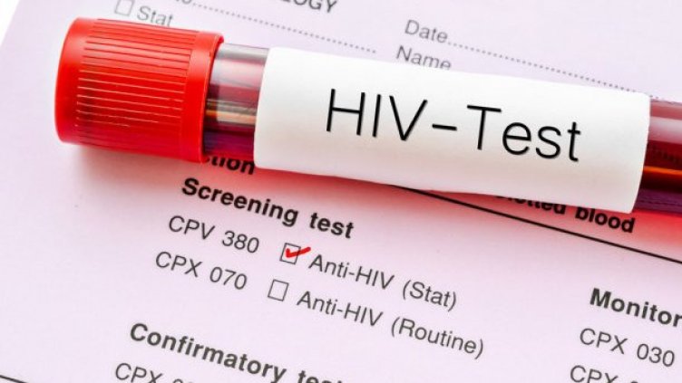 Днес е Международен ден за съпричастност със засегнатите от ХИВ и СПИН