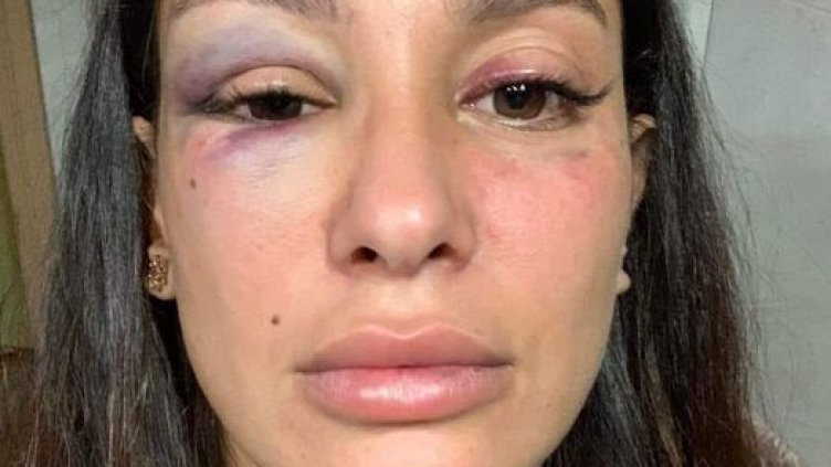 В мрежата: Варненка с призив срещу насилието над жени