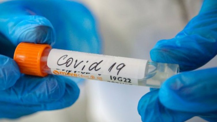 Единственото лечение на коронавируса засега e с хидроксихлорохин