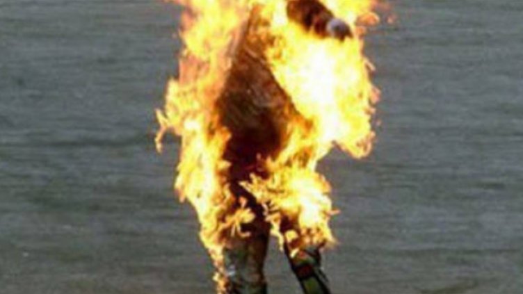 Остава критично състоянието на изгорелите мъж и жена