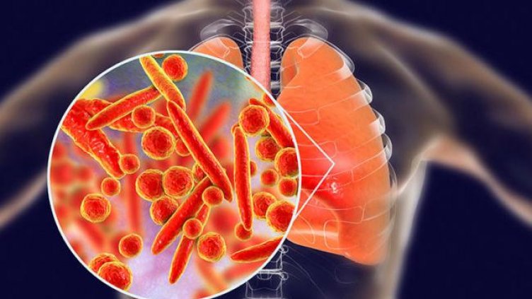 Нова зараза стресна човечеството