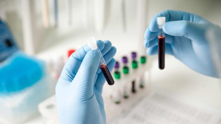 Сгрешени лабораторни резултати „докараха“ левкемия на дете във Варна