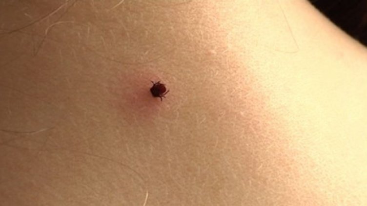 Кърлежите във Варна се активизираха