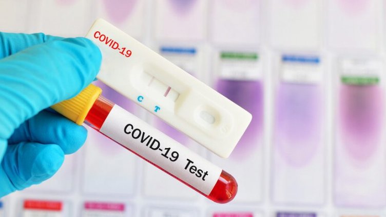 Плато: Малко над 1500 нови случая. Варна е втора, плътно следвана от Пловдив