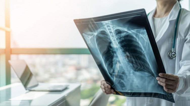 По какво си приличат COVID-19 и грипът