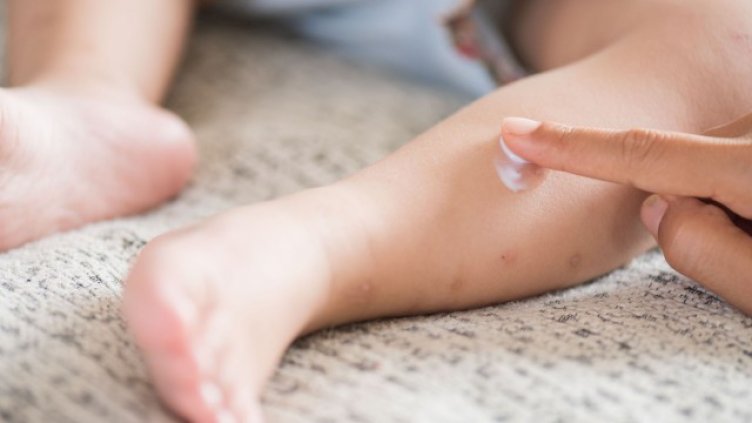 Официално регистрираните заразени с морбили у нас са 45