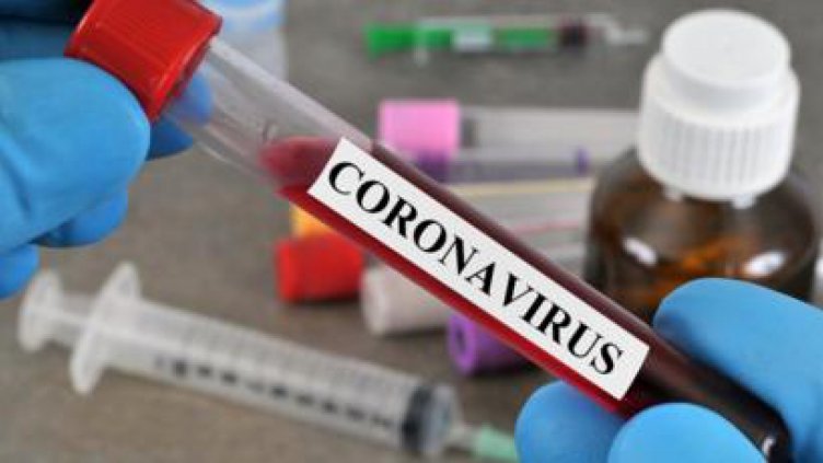 Над 81 400 жертви на COVID-19 в глобален мащаб