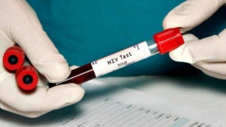 Липсват жизненоважни лекарства за серопозитивните пациенти