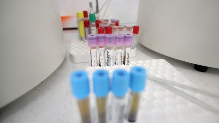 1850 са заразените, 3375 – оздравелите. Със 170 нови случая Варна е под №3