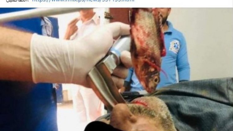 Лакомо дупе… Извадиха жива риба от гърлото на ненаситен рибар