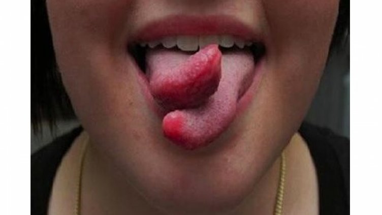 Пластичен хирург за подарък - хит е разцепен език, хиалурон и ботокс за Коледа