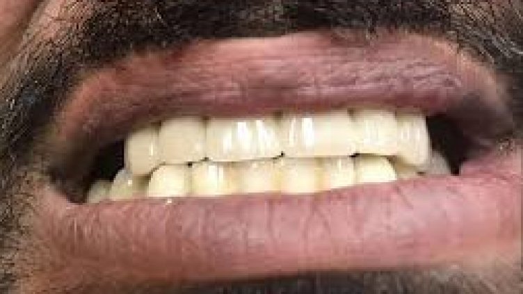 Напушен ухапа полицай