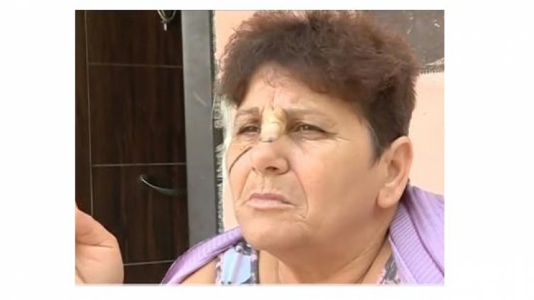 Ранена пътничка от автобуса: Вина не трябва да се търси единствено в шофьора