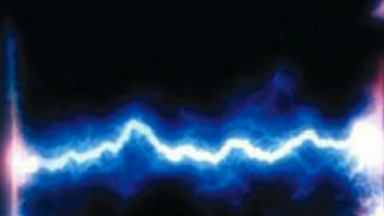 Детето, обгорено от волтова дъга, e в стабилно общо състояние