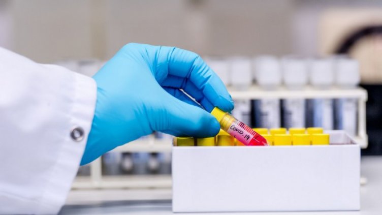 Започва масово тестване за коронавирус