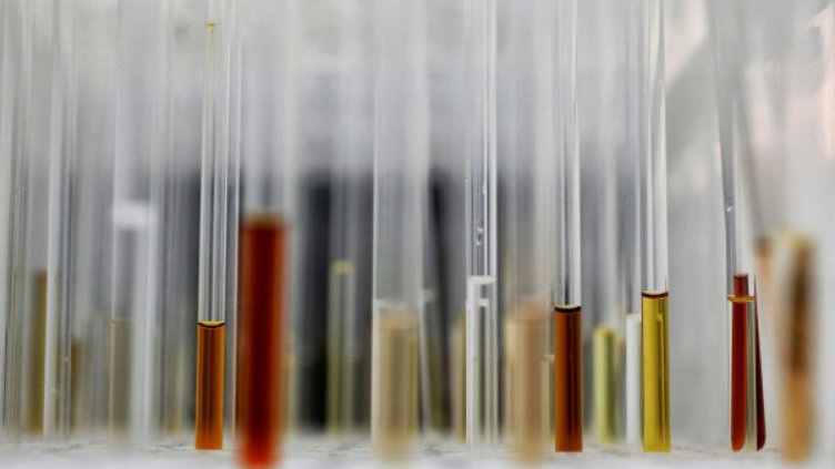 Взрив в руската лаботарория "Вектор" – там пазят ебола, едра шарка, СПИН...