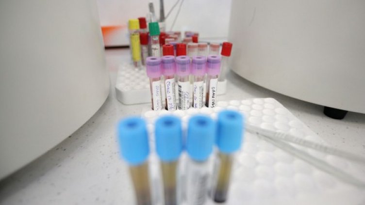 Спад на ковид заразата – 55 нови случая. 16 чисти области, Варна не е сред тях