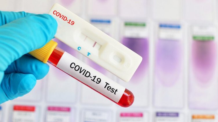 Варна на прага на 100-те случая. Нов ковид скок и ръст на процента заразени