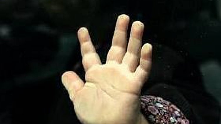 Детето с премръзнали крачета ще бъде дадено на ново приемно семейство