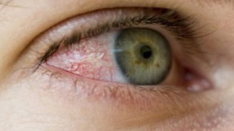 Извадиха паразити от окото на 7-месечно бебе във Варна