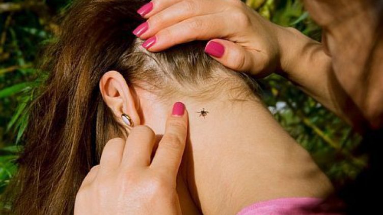 Лаймска болест и марсилска треска регистрираха във Варна