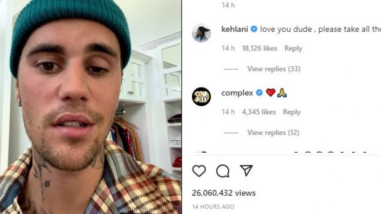 Тревожно: Джъстин Бийбър разкри, че страда от парализа (ВИДЕО)