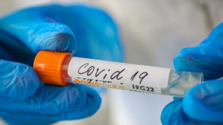 Проф. Кантарджиев: Пикът на коронавируса ще е в следващите дни