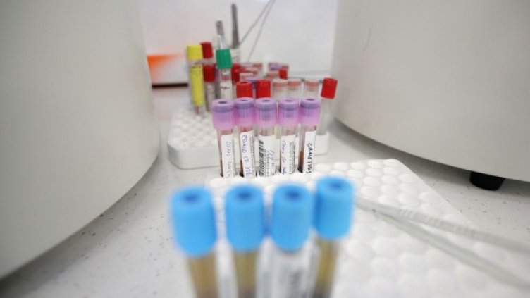 115 нови случая на COVID, 15 от които са във Варна