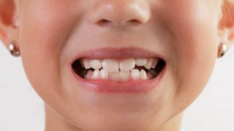  БЗС започва кампания за здрави зъбки при децата 