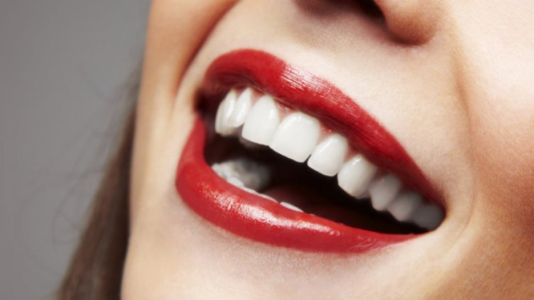 Кампания „Погрижи се за венците си!“ започва във Варна