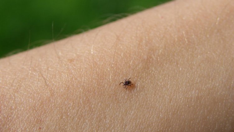 Отново десетки ухапани от кърлежи във Варна