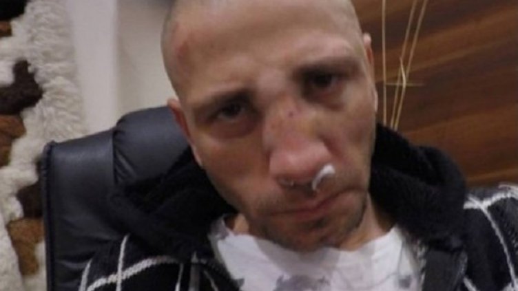 Пребитият Димитър. Снимка: Facebook