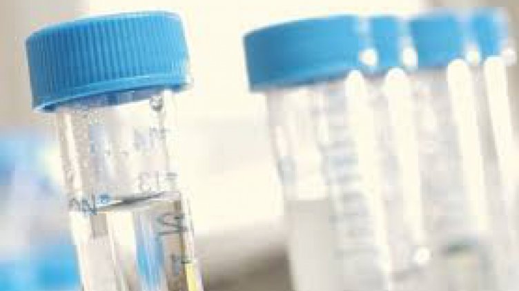 Изследват водата за пиене във Варна с нова апаратура