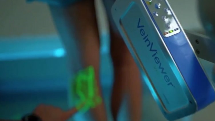 Лошо: 37% от българите страдат от разширени вени