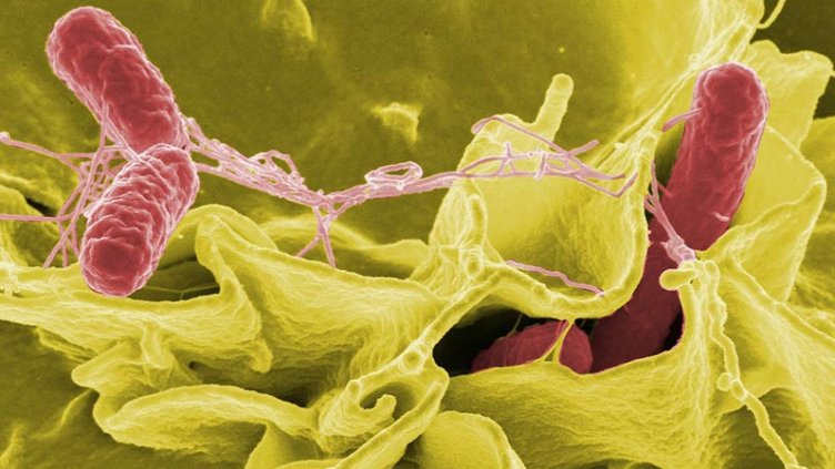 Тревожно: Пациент почина от салмонела във Варна