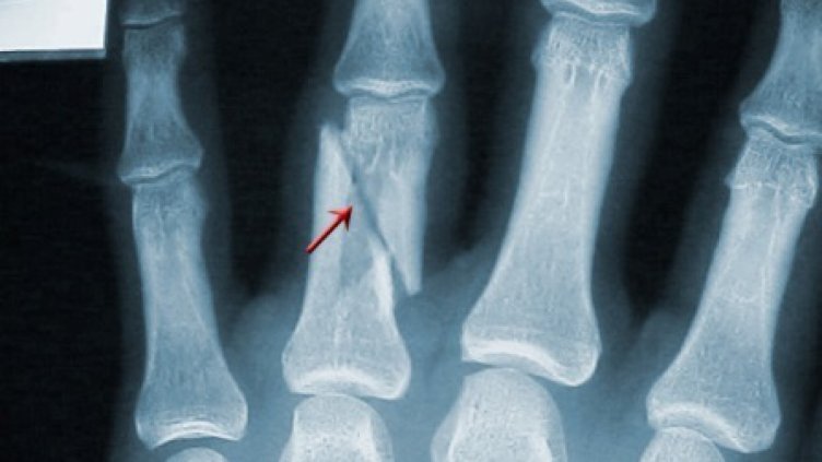 Мъж от Синдел чупи пръсти в центъра на Варна