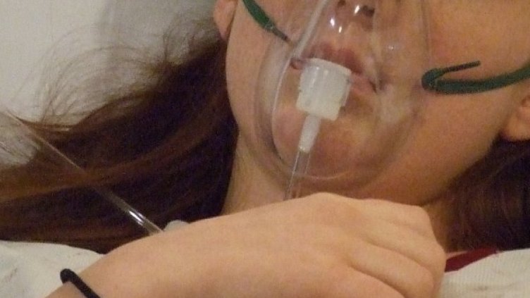 Няма опасност за живота на обгазените в Пазарджик