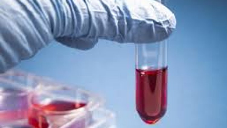 Обезопасиха площадката, където откриха епруветки с кръв