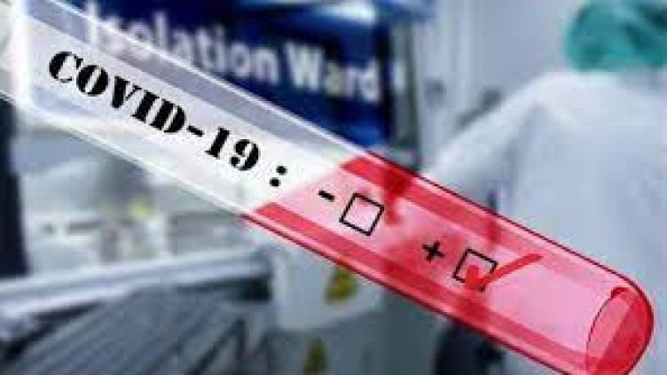 Заразените с COVID се увеличават: 549 са новите случаи, 44 от тях са от Варна