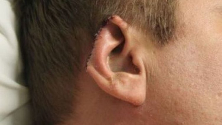 Мъж с отрязано ухо бере душа след меле на Трифон Зарезан