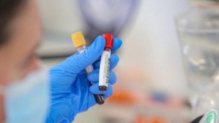 COVID-19 погуби 19-годишен